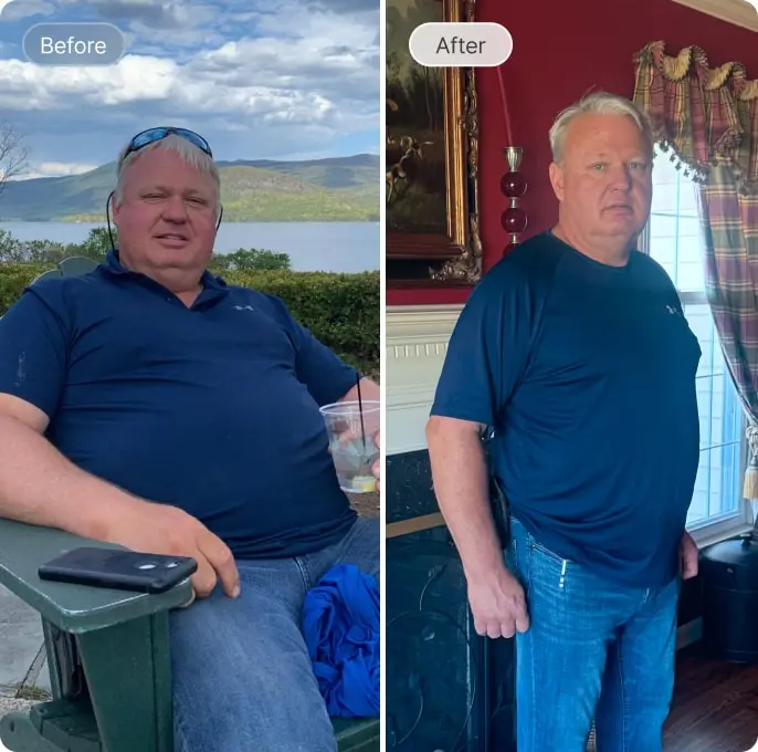 Mark Before and After